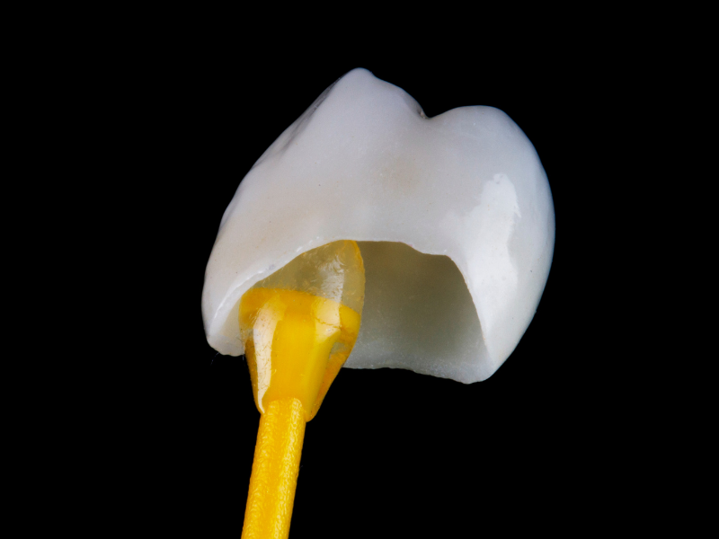 CEREC Dental Crowns Near Me