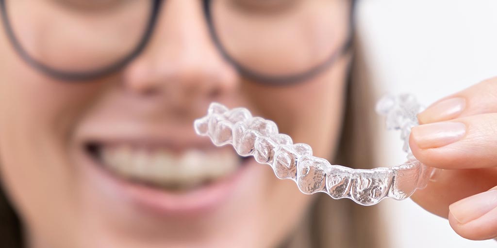 Clear Aligners