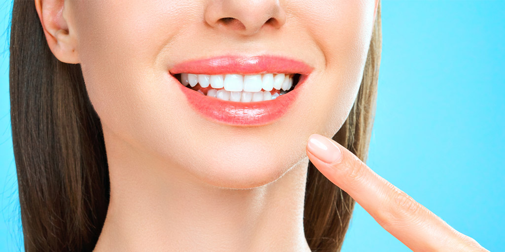 Teeth Whitening