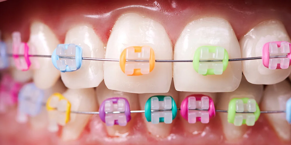 Orthodontics Evaluation
