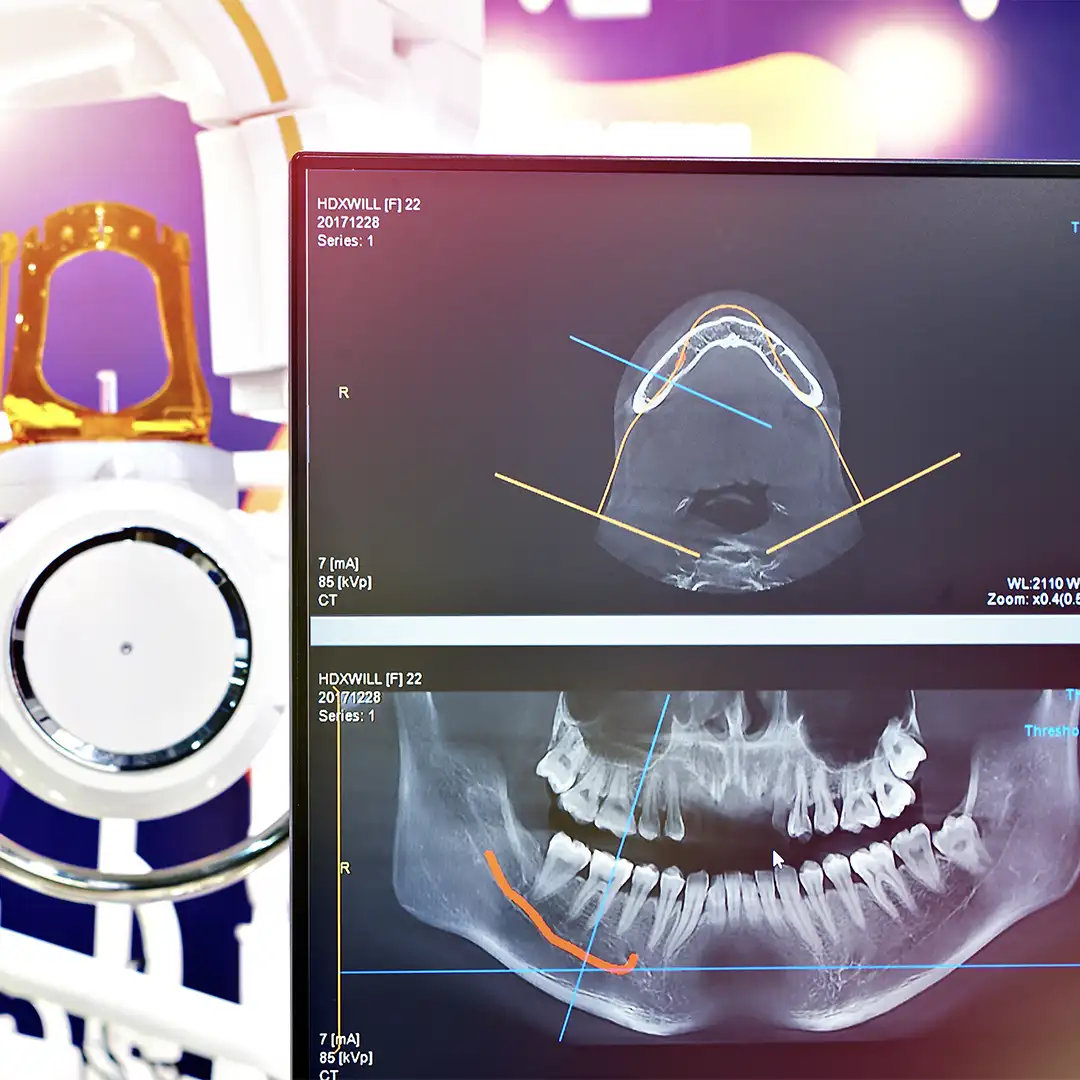 Digital X-rays