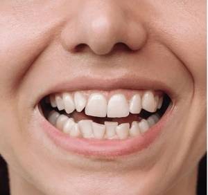 cosmetic dentist